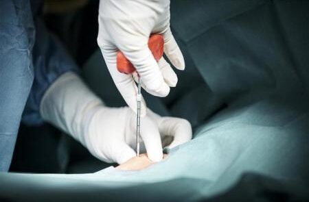 Biopsy