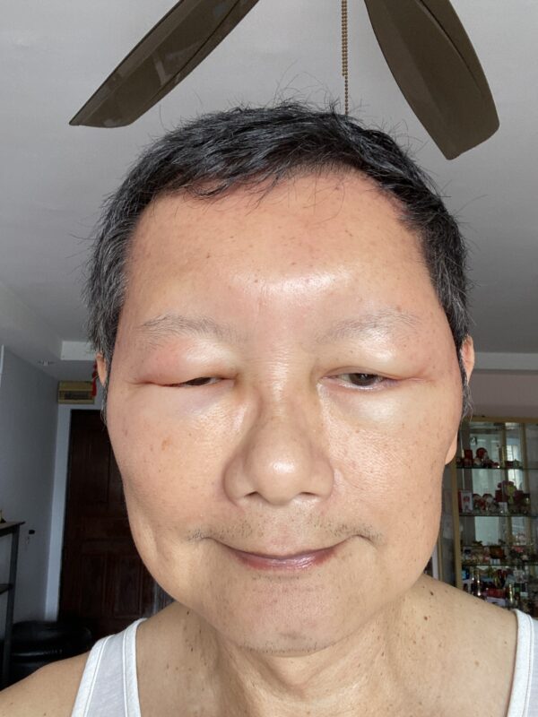 2021 - Skin Allergy and Treatment — photo