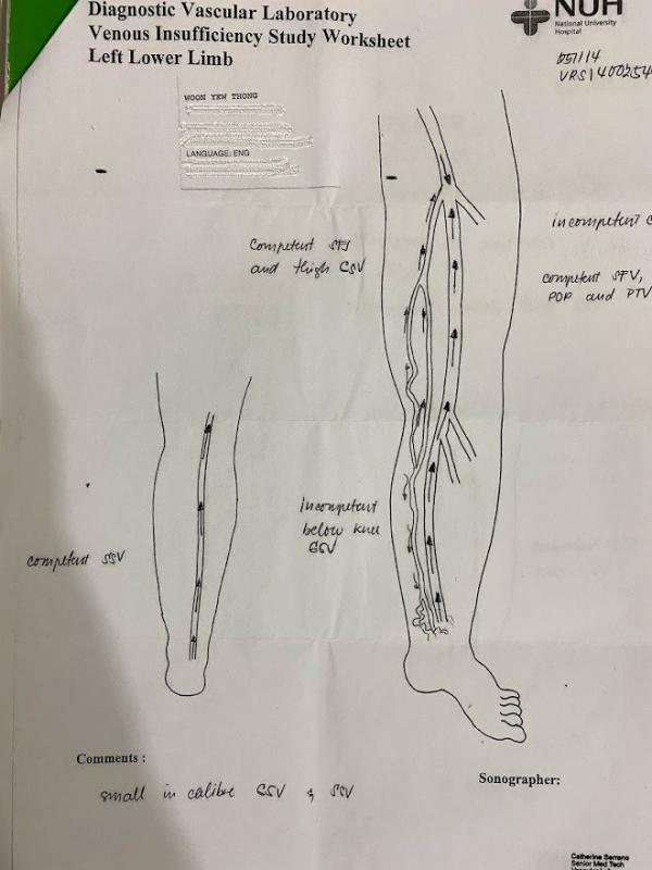 Weak Knee