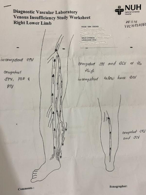 Weak Knee