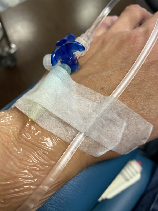 Day 1 2022 Chemo Therapy